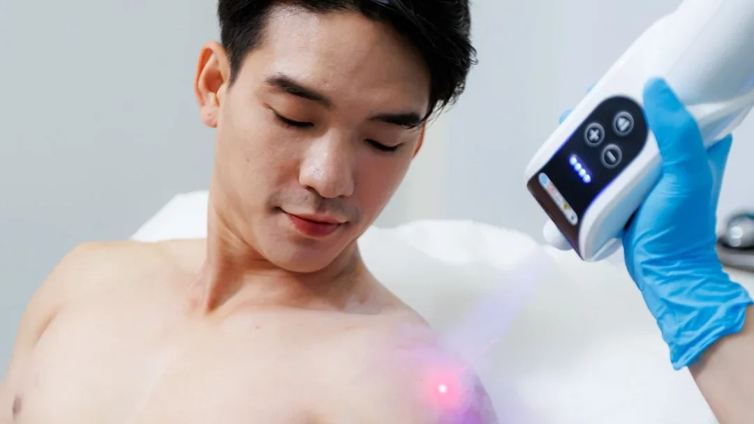 Localized Cryotherapy treatment at °CRYO On